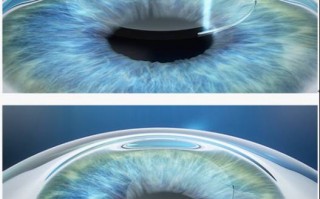 镜片厚度受什么影响，镜片厚度对照表