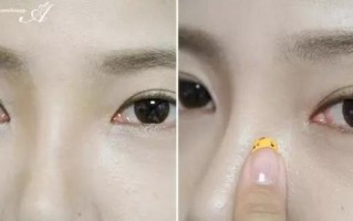 眼镜鼻梁发黄怎么办，眼镜鼻梁架断了怎么修复