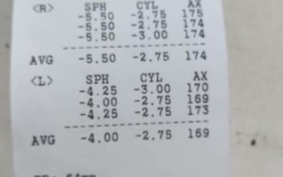 散光美瞳度数怎么算，散光200度相当于近视多少度
