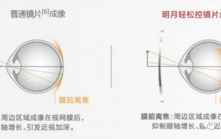 什么品牌镜片能控制视力，什么品牌镜片能控制视力的